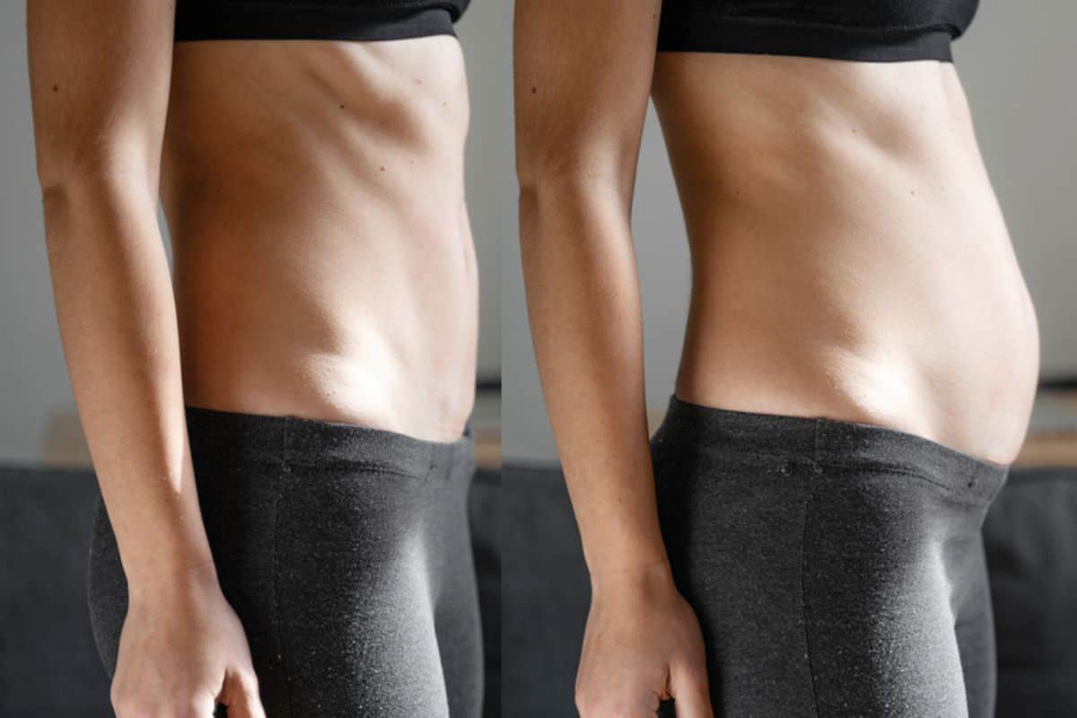 How long does diastasis recti take to improve North Kensington?