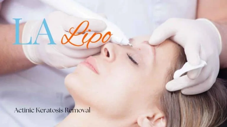 Woman receiving Actinic Keratosis Removal Treatment North Kensington