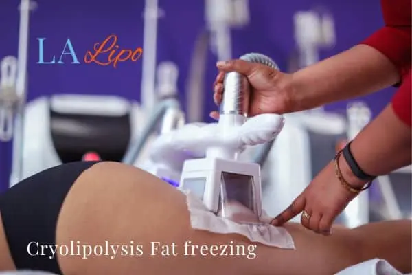 women getting fat freezing North Kensington