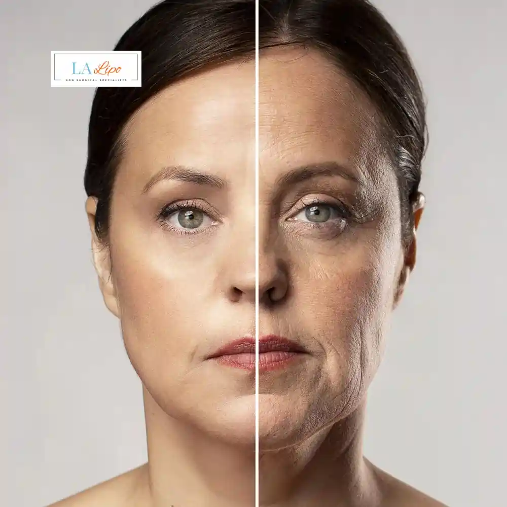 How Can You Tell If Non-Surgical Skin Tightening Is Right for You North Kensington?