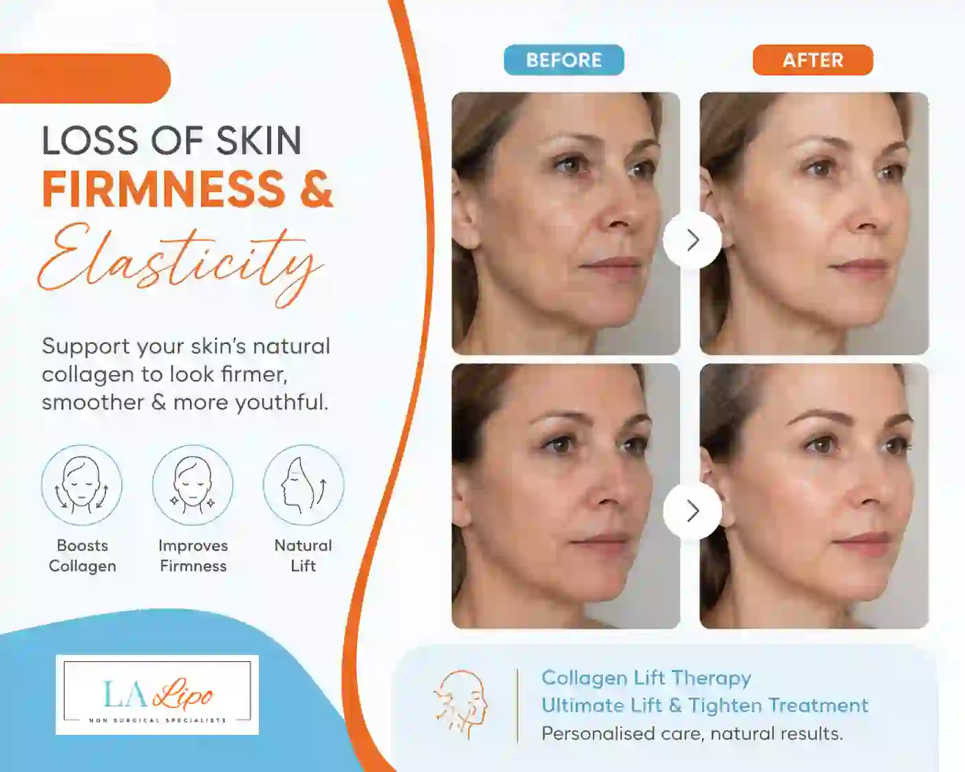 Sign #7: Loss of Skin Firmness and Elasticity North Kensington